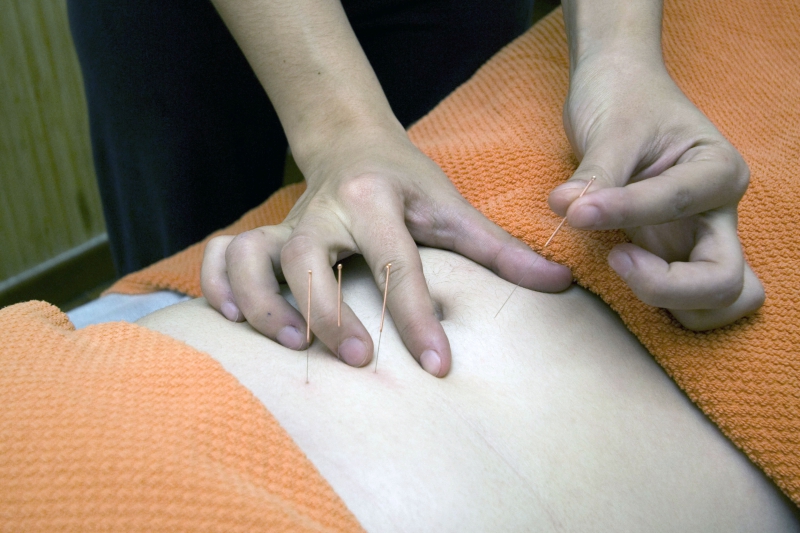 osteopathe-CONSEGUDES-min_acupuncture-4175625